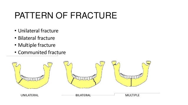 Complications of mandibular fracture