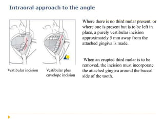 Mandibular fracture | PPTX