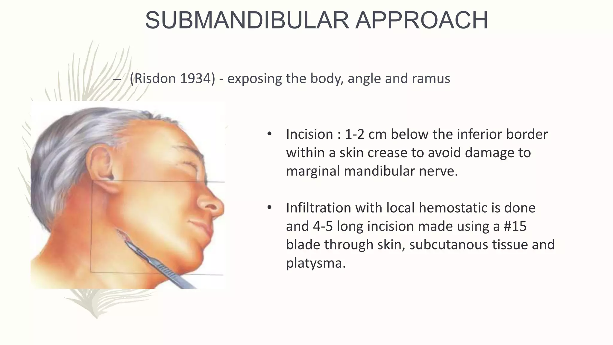 Mandibular Fracture.ppt