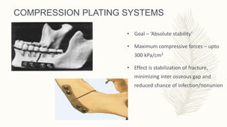 Mandibular Fracture.ppt
