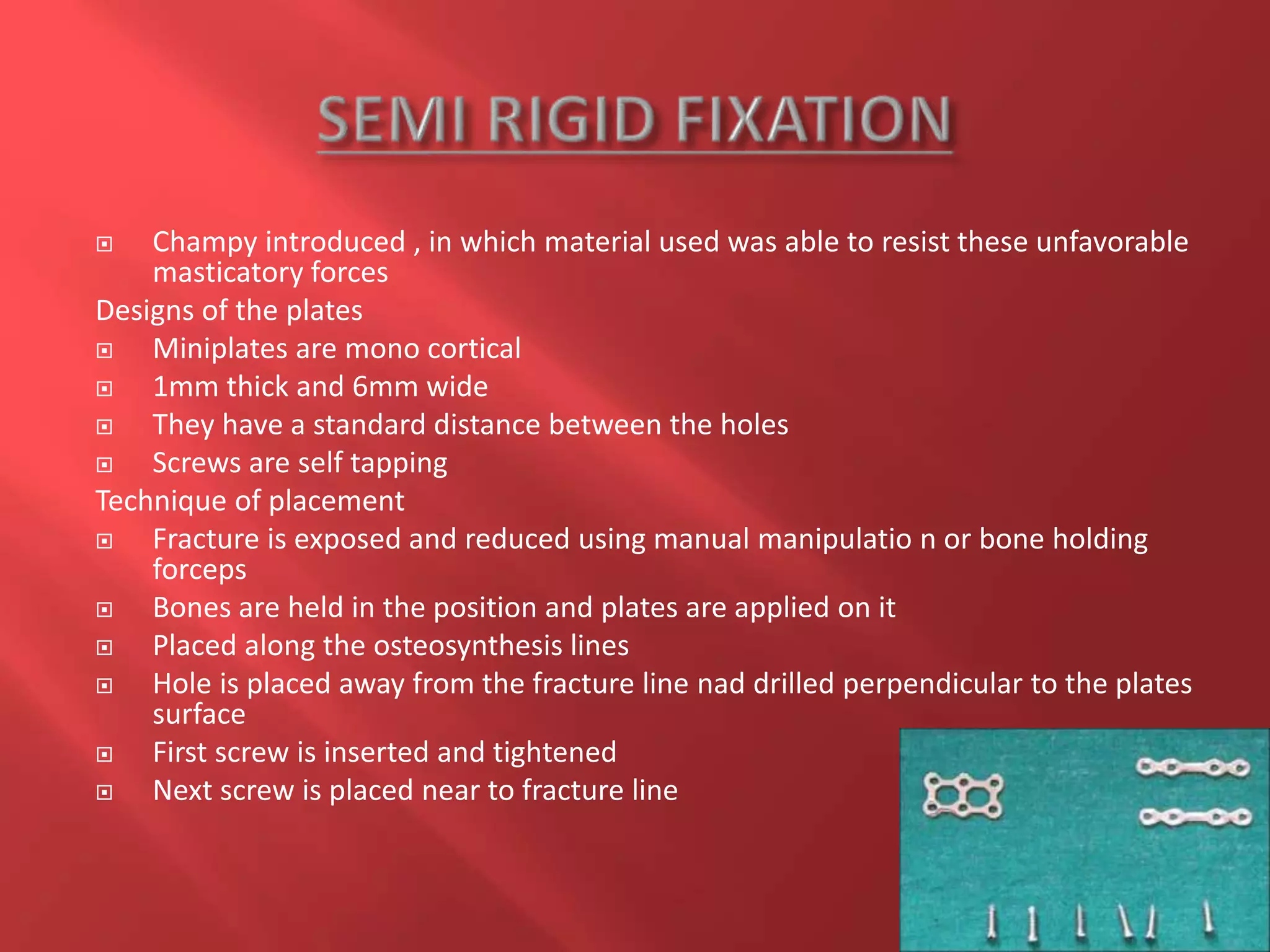  Champy introduced , in which material used was able to resist these unfavorable
masticatory forces
Designs of the plates
 Miniplates are mono cortical
 1mm thick and 6mm wide
 They have a standard distance between the holes
 Screws are self tapping
Technique of placement
 Fracture is exposed and reduced using manual manipulatio n or bone holding
forceps
 Bones are held in the position and plates are applied on it
 Placed along the osteosynthesis lines
 Hole is placed away from the fracture line nad drilled perpendicular to the plates
surface
 First screw is inserted and tightened
 Next screw is placed near to fracture line
 