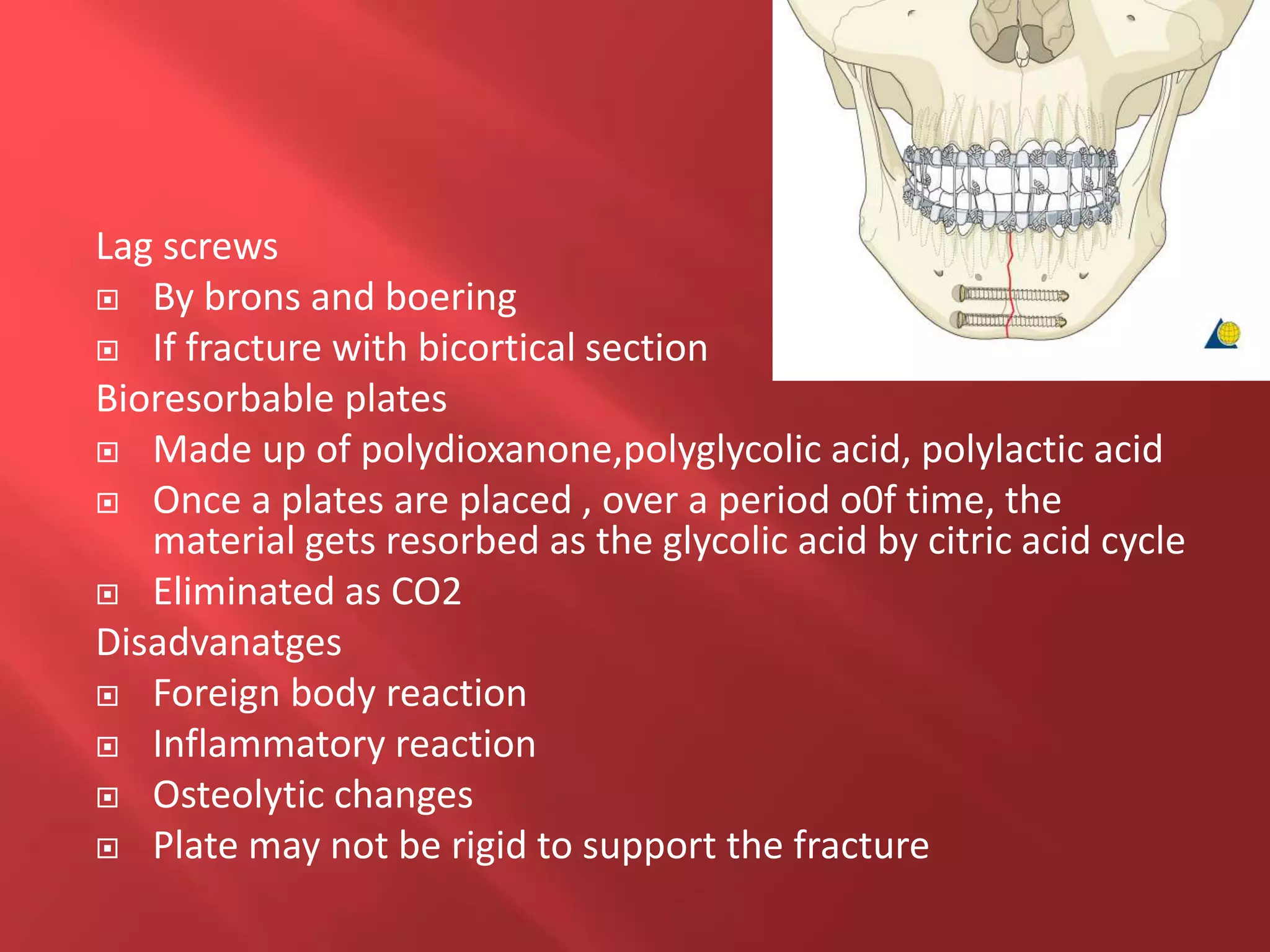Lag screws
 By brons and boering
 If fracture with bicortical section
Bioresorbable plates
 Made up of polydioxanone,polyglycolic acid, polylactic acid
 Once a plates are placed , over a period o0f time, the
material gets resorbed as the glycolic acid by citric acid cycle
 Eliminated as CO2
Disadvanatges
 Foreign body reaction
 Inflammatory reaction
 Osteolytic changes
 Plate may not be rigid to support the fracture
 