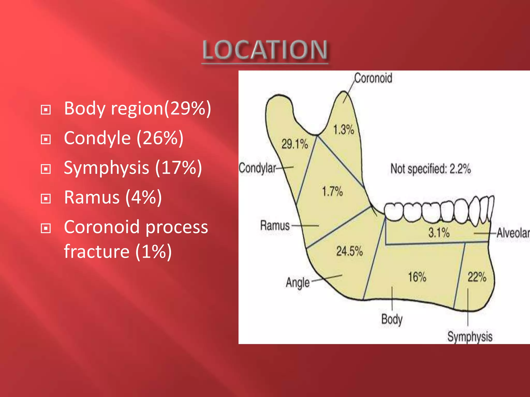  Body region(29%)
 Condyle (26%)
 Symphysis (17%)
 Ramus (4%)
 Coronoid process
fracture (1%)
 