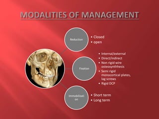 Reduction
• Closed
• open
Fixation
• Internal/external
• Direct/indirect
• Non rigid wire
osteosynthhesis
• Semi rigid
monocortical plates,
lag screws
• Rigid DCP
Immobilizati
on
• Short term
• Long term
 