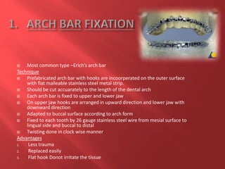  Most common type –Erich’s arch bar
Technique
 Prefabricated arch bar with hooks are incoorperated on the outer surface
with flat malleable stainless steel metal strip.
 Should be cut accuarately to the length of the dental arch
 Each arch bar is fixed to upper and lower jaw
 On upper jaw hooks are arranged in upward direction and lower jaw with
downward direction
 Adapted to buccal surface according to arch form
 Fixed to each tooth by 26 gauge stainless steel wire from mesial surface to
lingual side and buccal to distal
 Twisting done in clock wise manner
Advantages
1. Less trauma
2. Replaced easily
3. Flat hook Donot irritate the tissue
 