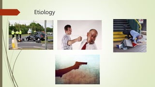 Etiology
 