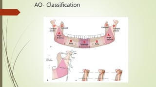 AO- Classification
 