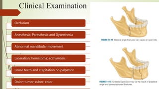 Clinical Examination
Occlusion
Anesthesia; Paresthesia and Dysesthesia
Abnormal mandibular movement
Laceration; hematoma; ecchymosis
Loose teeth and crepitation on palpation
Dolor; tumor; rubor; color
 
