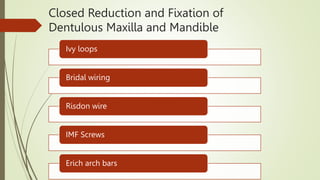 Closed Reduction and Fixation of
Dentulous Maxilla and Mandible
Ivy loops
Bridal wiring
Risdon wire
IMF Screws
Erich arch bars
 