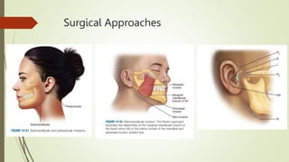 Surgical Approaches
 