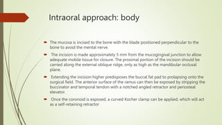 Intraoral approach: body
 The mucosa is incised to the bone with the blade positioned perpendicular to the
bone to avoid the mental nerve.
 The incision is made approximately 5 mm from the mucogingival junction to allow
adequate mobile tissue for closure. The proximal portion of the incision should be
carried along the external oblique ridge, only as high as the mandibular occlusal
plane.
 Extending the incision higher predisposes the buccal fat pad to prolapsing onto the
surgical field. The anterior surface of the ramus can then be exposed by stripping the
buccinator and temporal tendon with a notched angled retractor and periosteal
elevator.
 Once the coronoid is exposed, a curved Kocher clamp can be applied, which will act
as a self-retaining retractor
 