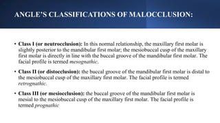 MANDIBULAR FRACTURE in plastic surgery.pptx