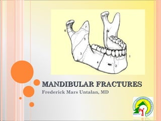 MANDIBULAR FRACTURESMANDIBULAR FRACTURES
Frederick Mars Untalan, MD
 