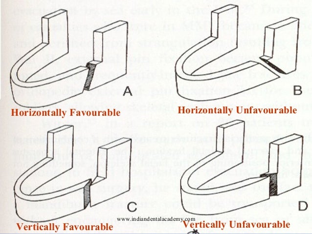 Mandibular fractures /...