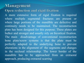 Mandibular fractures | PPTX