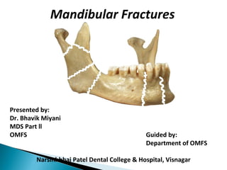 Presented by:
Dr. Bhavik Miyani
MDS Part ll
OMFS Guided by:
Department of OMFS
Narsinhbhai Patel Dental College & Hospital, Visnagar
Mandibular Fractures
 