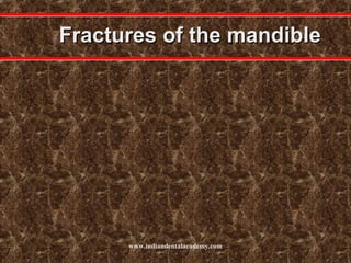 Fractures of the mandible

www.indiandentalacademy.com

 