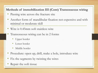 Methods of immobilization III (Cont) Transosseous wiring
• Passing wire across the fracture site
• Another form of mandibular fixation not expensive and with
minimal or moderate skill
• Wire is 0.45mm soft stainless wire
• Transosseous wiring can be in 2 forms
• Upper border
• Lower border
• Middle border
• Procedure: open up, drill, make a hole, introduce wire
• Fix the segments by twisting the wires
• Repair the soft tissue
 