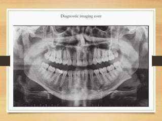 Diagnostic imaging cont
• Orthopanthomogram
 