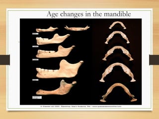 Age changes in the mandible
 