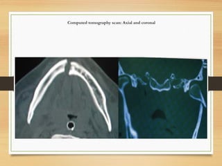 Computed tomography scan: Axial and coronal
 