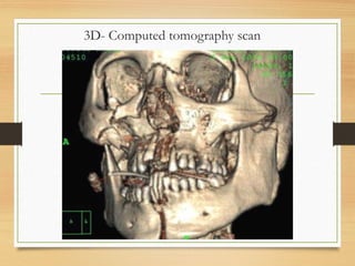 3D- Computed tomography scan
 