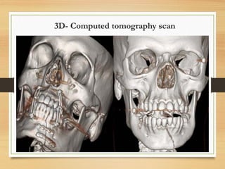 3D- Computed tomography scan
 
