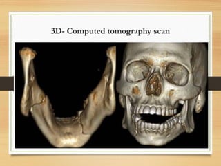 3D- Computed tomography scan
 