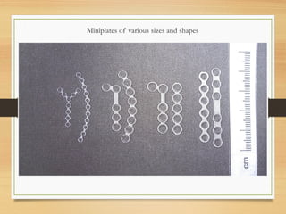 Miniplates of various sizes and shapes
 
