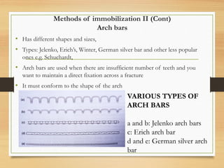 Methods of immobilization II (Cont)
Arch bars
• Has different shapes and sizes,
• Types: Jelenko, Erich’s, Winter, German silver bar and other less popular
ones e.g. Schuchardt,
• Arch bars are used when there are insufficient number of teeth and you
want to maintain a direct fixation across a fracture
• It must conform to the shape of the arch
VARIOUS TYPES OF
ARCH BARS
a and b: Jelenko arch bars
c: Erich arch bar
d and e: German silver arch
bar
 