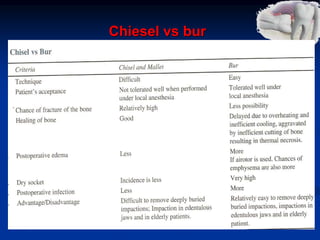 Chiesel vs bur
 
