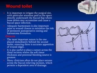 Wound toilet
It is important to irrigate the surgical site,
with particular attention paid to the space
directly underneath the buccal flap where
loose debris may accumulate and cause a
buccal space infection.
Adequate haemostasis is also important
prior to wound closure to minimize the risk
of persistent postoperative oozing and
haematoma formation.
Closure
The most important suture is the one
placed immediately behind the second
molar, ensuring there is accurate apposition
of wound edges .
It is also useful to place a suture across the
distal incision where the soft tissue
thickness and potential bleeding source is
greatest.
Many clinicians often do not place sutures
across the buccal relieving incision, which
permits a dependent area of drainage.
 