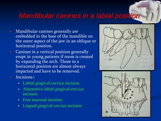 Mandibular canines in a labial position
Mandibular canines generally are
embedded in the base of the mandible on
the outer aspect of the jaw in an oblique or
horizontal position.
Canines in a vertical position generally
erupt in young patients if room is created
by expanding the arch. Those in a
horizontal position are almost always
impacted and have to be removed.
Incisions :
Labial gingival crevice incision.
Alternative labial gingival crevice
incision.
Free mucosal incision.
Lingual gingival crevice incision
 