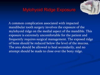 Mylohyoid Ridge Exposure
A common complication associated with impacted
mandibular tooth surgery involves the exposure of the
mylohyoid ridge on the medial aspect of the mandible. This
exposure is extremely uncomfortable for the patient and
frequently requires surgical management. The exposed ridge
of bone should be reduced below the level of the mucosa.
The area should be allowed to heal secondarily, and no
attempt should be made to close over the bony ridge.
 