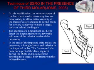 Technique of SSRO IN THE PRESENCE
OF THIRD MOLAR(JOMS, 2005)
In this modification, the anterior aspect of
the horizontal medial osteotomy is open
more widely to allow better visibility of
the marrow cavity and also to permit room
for a rotary handpiece to make a lingual
back cut behind the lingula.
The addition of a lingual back cut helps
direct the lingual fracture to a favorable
split toward the inferior border of the
osteotomy.
In the area of the impacted third molar, the
osteotomy is brought lateral and inferior to
the impacted molar. This “buttresses” the
posterior aspect of the distal segment
during the SSRO and minimizes the
potential for a lingual body fracture in this
vulnerable area .
 