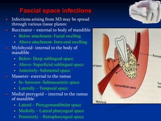 Fascial space infections
Infections arising from M3 may be spread
through various tissue planes:
Buccinator – external to body of mandible
Below attachment- Facial swelling
Above attachment- Intra-oral swelling
Mylohyoid- internal to the body of
mandible
Below- Deep sublingual space
Above- Superficial sublingual space
Anteriorly- Submental space
Masseter- external to the ramus
In- between- Submasseteric space
Laterally – Temporal space
Medial pterygoid – internal to the ramus
of mandible
Lateral – Pterygomandibular space
Medially – Lateral pharyngeal space
Posteriorly – Retropharyngeal space
 