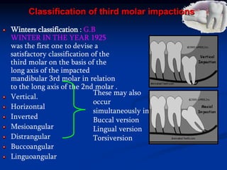 Classification of third molar impactions
Winters classification : G.B
WINTER IN THE YEAR 1925
was the first one to devise a
satisfactory classification of the
third molar on the basis of the
long axis of the impacted
mandibular 3rd molar in relation
to the long axis of the 2nd molar .
Vertical.
Horizontal
Inverted
Mesioangular
Distrangular
Buccoangular
Linguoangular
These may also
occur
simultaneously in :
Buccal version
Lingual version
Torsiversion
 