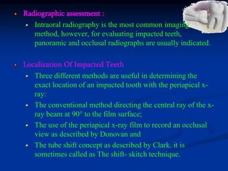 Radiographic assessment :
Intraoral radiography is the most common imaging
method, however, for evaluating impacted teeth,
panoramic and occlusal radiographs are usually indicated.
Localization Of Impacted Teeth
Three different methods are useful in determining the
exact location of an impacted tooth with the periapical x-
ray:
The conventional method directing the central ray of the x-
ray beam at 90° to the film surface;
The use of the periapical x-ray film to record an occlusal
view as described by Donovan and
The tube shift concept as described by Clark. it is
sometimes called as The shift- skitch technique.
 
