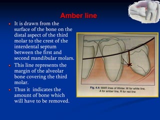 Amber line
It is drawn from the
surface of the bone on the
distal aspect of the third
molar to the crest of the
interdental septum
between the first and
second mandibular molars.
This line represents the
margin of the alveolar
bone covering the third
molar.
Thus it indicates the
amount of bone which
will have to be removed.
 
