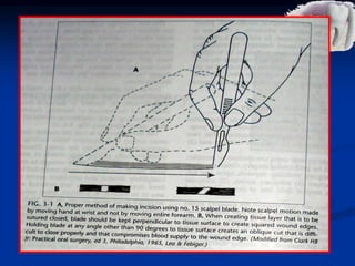 Principles of Incisions
First - A sharp blade of the proper size should be used. A sharp blade allows
incisions to be made cleanly, without unnecessary damage caused by
repeated strokes. The rate at which a blade dulls depends on the resistance of
tissues through which the blade cuts.
Second - A firm, continuous stroke should be used when incising. Repeated,
tentative strokes increase both the amount of damaged tissue within a wound
and the amount of bleeding, thereby impairing wound healing .
Third - The surgeon should carefully avoid cutting vital structures when
incising.
Fourth - Incisions through epithelial surfaces that the surgeon plans to
reapproximate should be made with the blade held perpendicular to the
epithelial surface. This angle produces squared wound edges that are both
easier to reorient properly during suturing and less susceptible to necrosis of
the wound edges as a result of ischemia.
Fifth - Incisions in the oral cavity should be properly placed. It is more
desirable to incise through attached gingiva and over healthy bone than
through unattached gingiva and over unhealthy or missing bone.
 