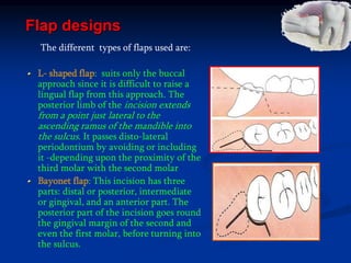 Flap designs
The different types of flaps used are:
L- shaped flap: suits only the buccal
approach since it is difficult to raise a
lingual flap from this approach. The
posterior limb of the incision extends
from a point just lateral to the
ascending ramus of the mandible into
the sulcus. It passes disto-lateral
periodontium by avoiding or including
it -depending upon the proximity of the
third molar with the second molar
Bayonet flap: This incision has three
parts: distal or posterior, intermediate
or gingival, and an anterior part. The
posterior part of the incision goes round
the gingival margin of the second and
even the first molar, before turning into
the sulcus.
 