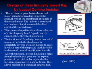 Design of disto lingually based flap
by buccal Comma incision
. The incision - a point below the second
molar, smoothly curved up to meet the
gingival crest at the distobuccal line angle of
the second molar. The incision is continued
as a crevicular incision around the distal
aspect of the second molar.
This comma-shaped incision allows reflection
of a distolingually based flap adequately
exposing the entire third molar area.
The incision and flap design seems best suited
to cases in which the third molar is
completely covered with soft tissues. In cases
in which part of the impacted tooth is visible
in the mouth, a small modification is made.
After the incision , a second incision is made
from the distobuccal point on the exposed
portion of the third molar to join the first
incision approximately midway down . This
allows excision of a triangular gingival flap.
(Joms 2002)
 