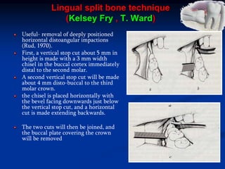 Lingual split bone technique
(Kelsey Fry , T. Ward)
Useful- removal of deeply positioned
horizontal distoangular impactions
(Rud, 1970).
First, a vertical stop cut about 5 mm in
height is made with a 3 mm width
chisel in the buccal cortex immediately
distal to the second molar.
A second vertical stop cut will be made
about 4 mm disto-buccal to the third
molar crown.
the chisel is placed horizontally with
the bevel facing downwards just below
the vertical stop cut, and a horizontal
cut is made extending backwards.
The two cuts will then be joined, and
the buccal plate covering the crown
will be removed
 