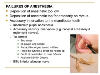 FAILURES OF ANESTHESIA:
 Deposition of anesthetic too low.
 Deposition of anesthetic too far anteriorly on ramus.
 Accessory innervation to the mandibular teeth





Incomplete pulpal anesthesia.
Accessory sensory innervation (e.g. cervical accessory &
mylohyoid nerves).
To correct









Technique
25 gauge long needle.
Retract the tongue toward midline
Place the syringe & direct the needle tip
Depth of penetration to bone:3-5mm.
Aspirate:0.6ml in 20secs

Bifid inferior alveolar nerve

 