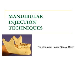 MANDIBULAR
INJECTION
TECHNIQUES

Chinthamani Laser Dental Clinic

 