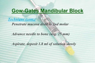 Mandibular injections