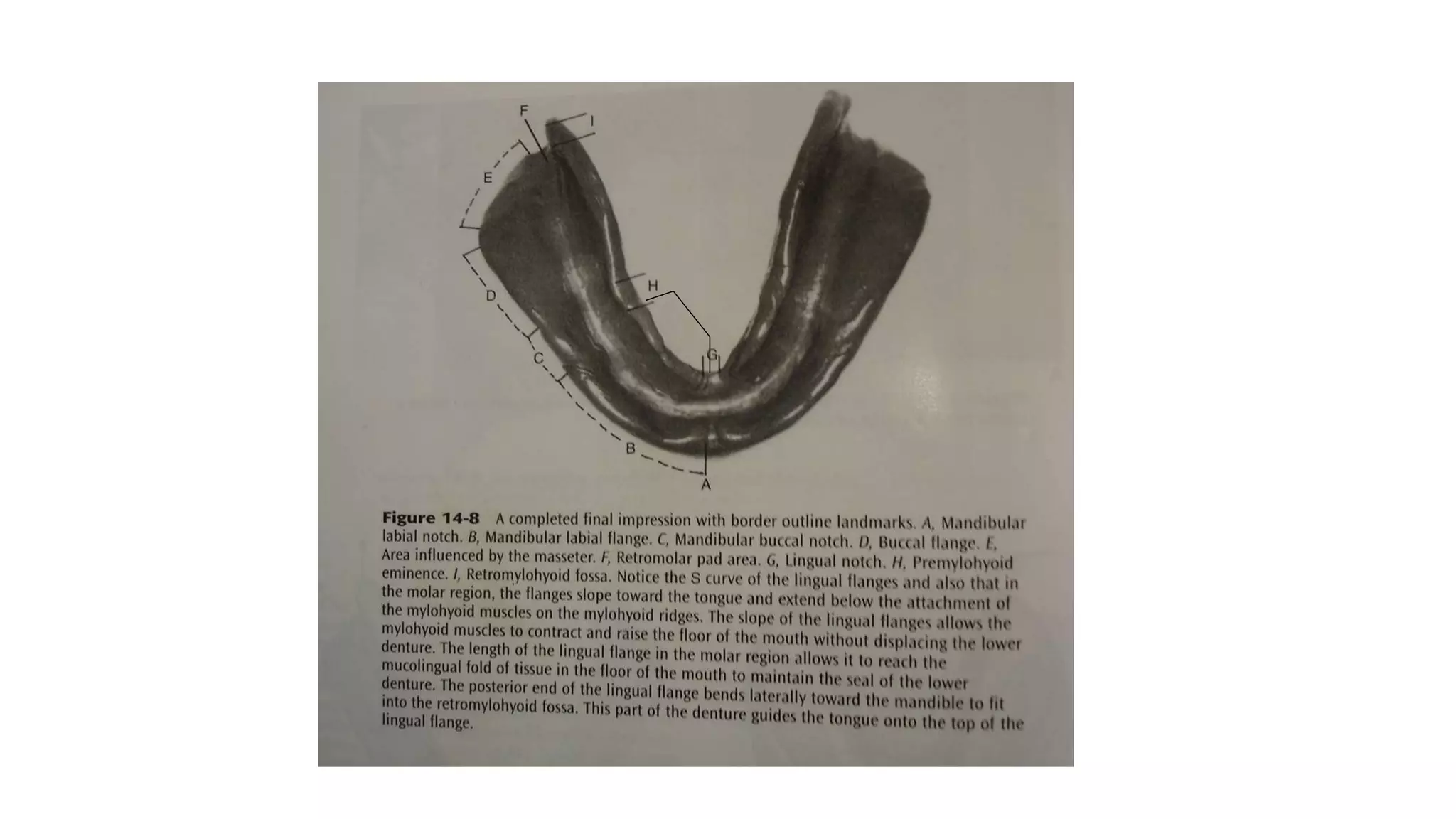 MANDIBULAR ANATOMICAL LANDMARKS | PPTX