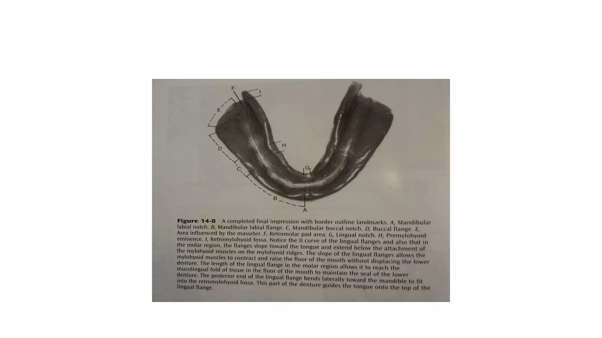 MANDIBULAR ANATOMICAL LANDMARKS | PPTX