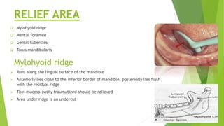 RELIEF AREA
 Mylohyoid ridge
 Mental foramen
 Genial tubercles
 Torus mandibularis
Mylohyoid ridge
 Runs along the lingual surface of the mandible
 Anteriorly lies close to the inferior border of mandible, posteriorly lies flush
with the residual ridge
 Thin mucosa-easily traumatized-should be relieved
 Area under ridge is an undercut
 