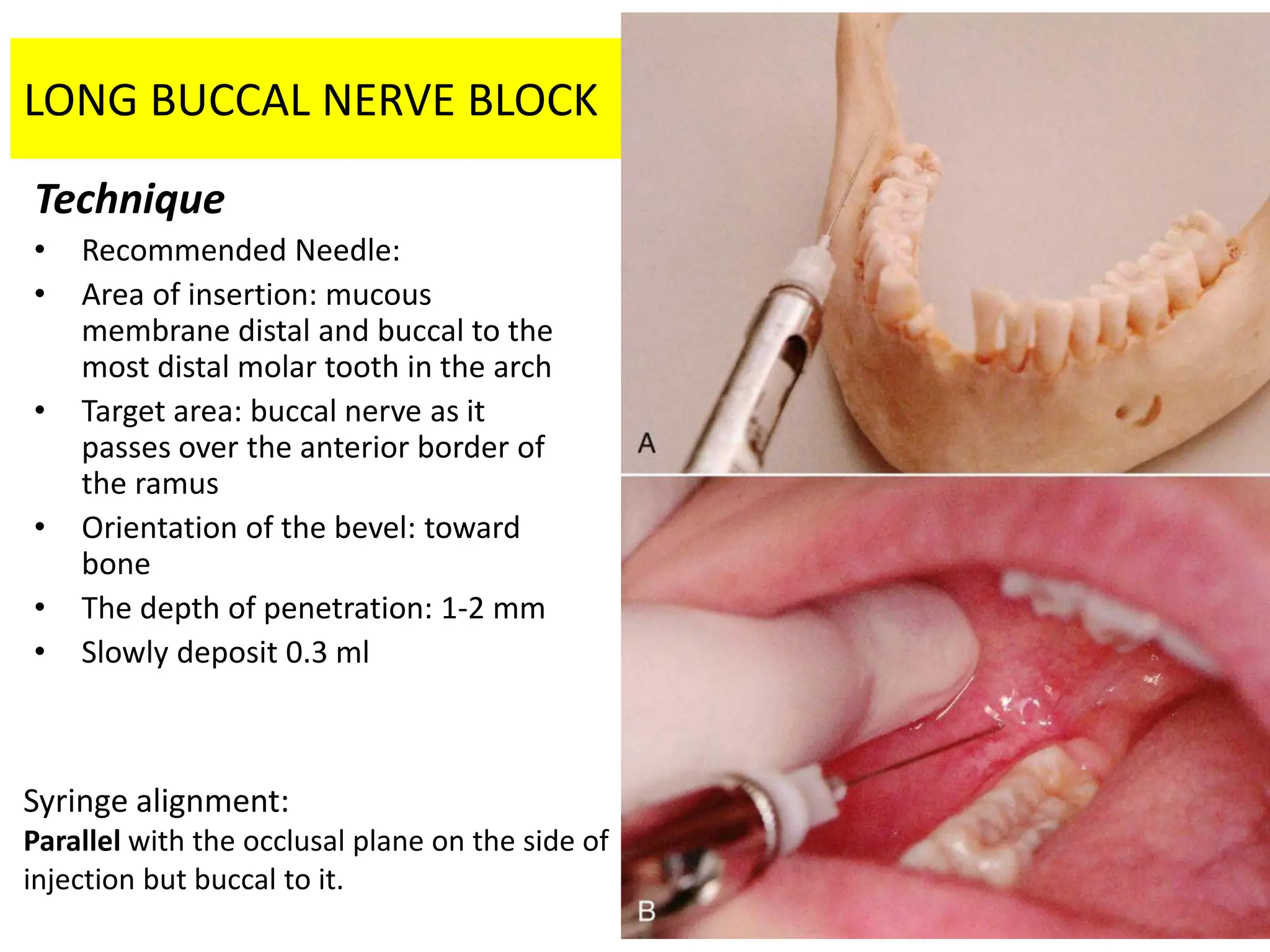 mandibular techniques in your area are here | PDF